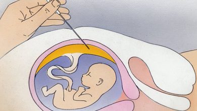 تست اطلاعات از مشکلات کودکتان